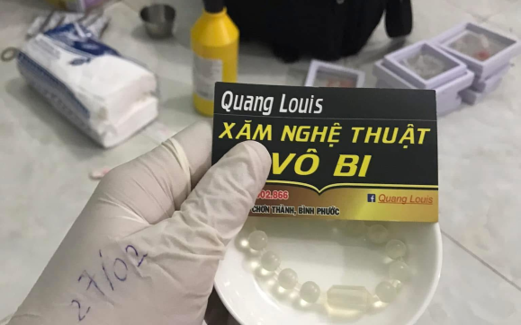 Vô bi chất lượng Chơn Thành – Dịch vụ vô bi vùng kín an toàn cho nam tại Quang Louis Tattoo